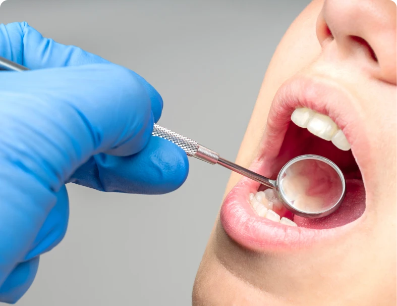 Dental checkup with mouth mirror tool.