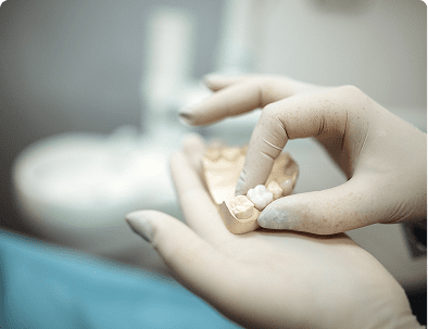 Dentist examining a dental mold model.